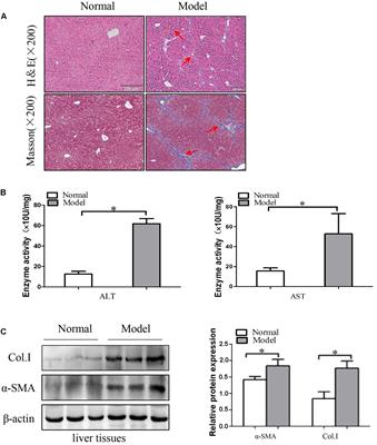 MicroRNA-145 Increases the Apoptosis of Activated Hepatic Stellate Cells Induced by TRAIL through NF-κB Signaling Pathway